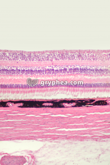 Rétine, choroïde et sclérotique CT x40 - gryphea.org